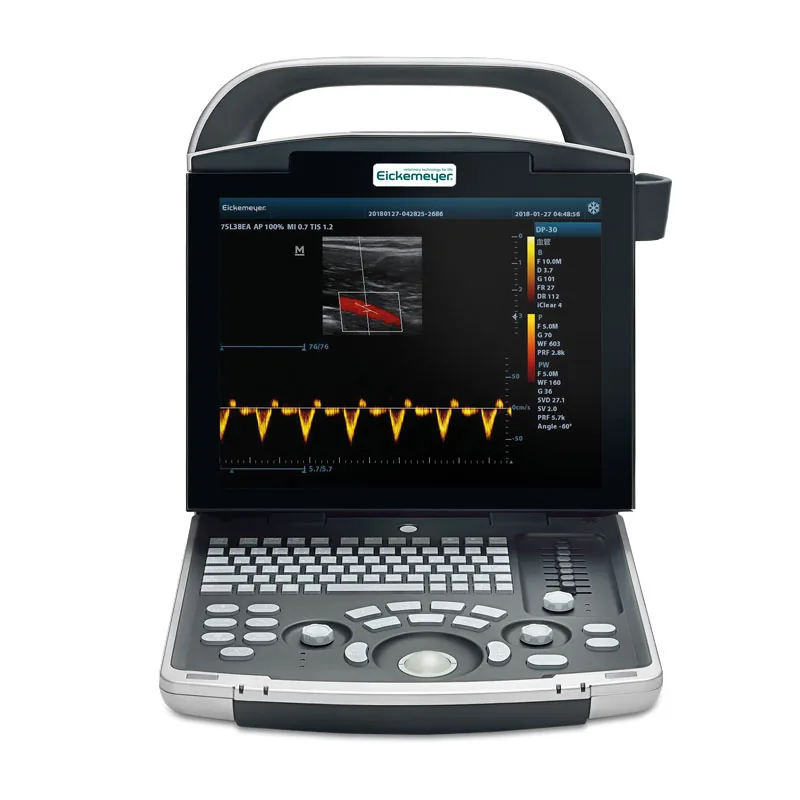 MAGIC 3000 Plus Ultrasound Unit